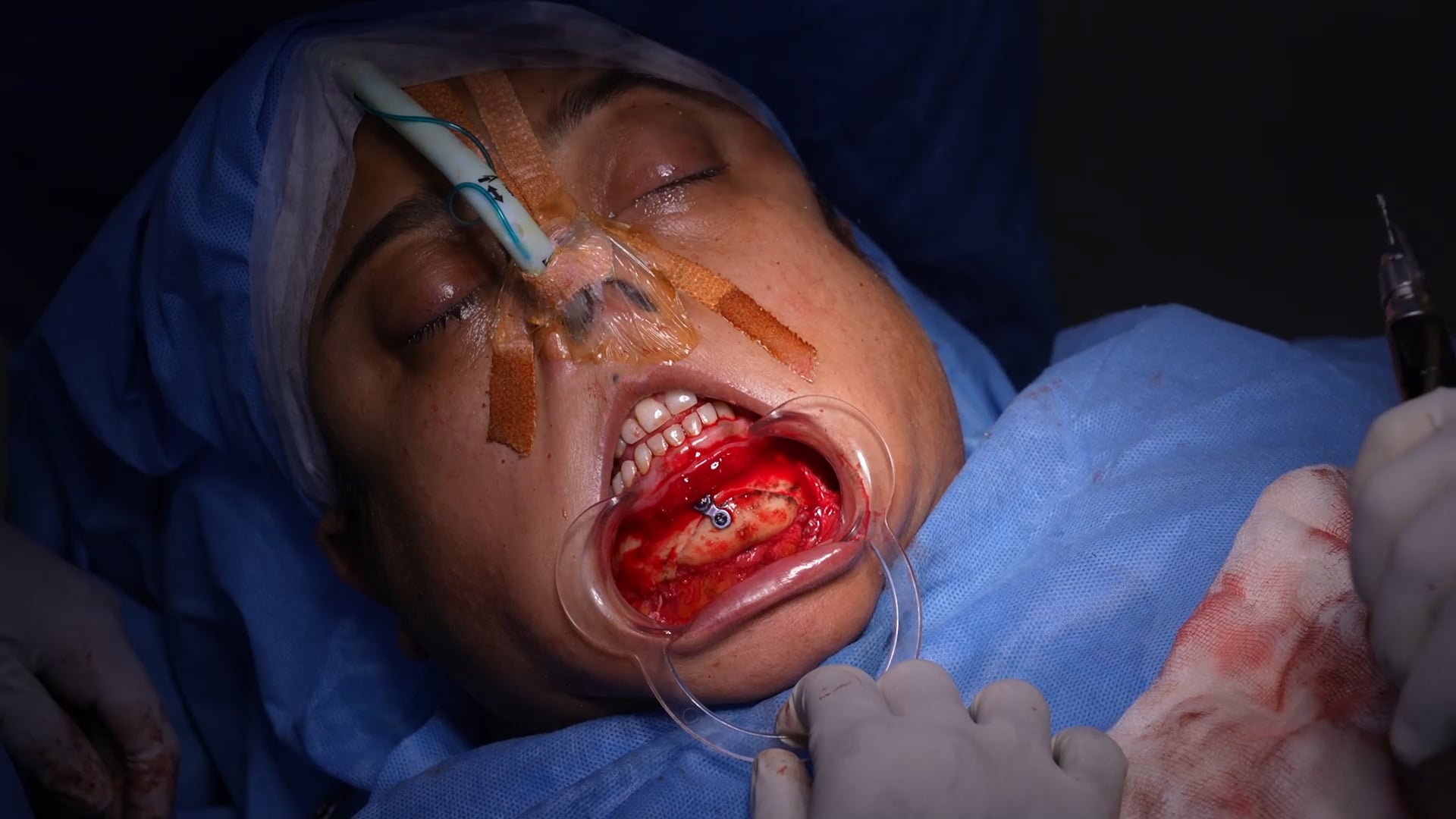 Face make over  surgery